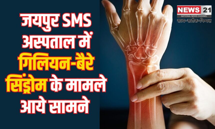 GBS Cases Also In Jaipur SMS: जयपुर के एसएमएस हॉस्पिटल में गुइलेन-बैरे सिंड्रोम के तीन केस मिले: प्रशासन अलर्ट