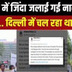 Odisha Girl Burning Case Update: ओडिशा में 15 साल की लड़की को जिंदा जलाने का मामला: AIIMS में मौत, सरकार ने बचाने की कोशिश की- डिप्टी सीएम