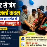 क्लबफुट